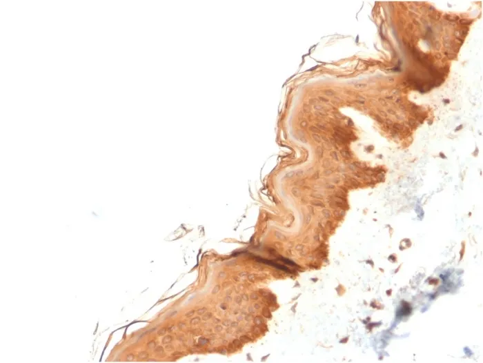 Anti-Cytokeratin 4 (KRT4)(KRT4/2804), CF405S conjugate - image 1