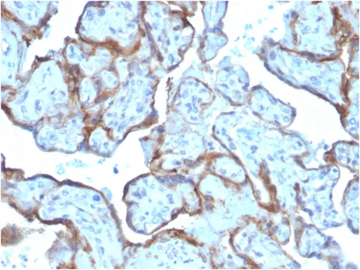 Anti-MMP3 (Marker of Metastasis and Rheumatoid Arthritis)(MMP3/2806) - image 1