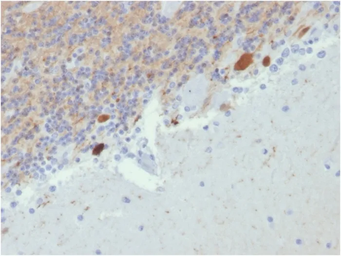 Anti-Calretinin / Calbindin 2 (Mesothelioma Marker)(CALB2/2807) - image 1