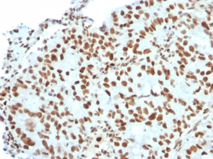 Anti-BMI1 (Oncogene and Stem Cell Marker)(BMI1/2823) - image 1