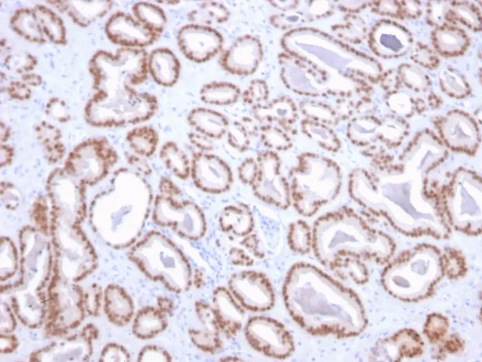 Anti-NKX3.1 (Metastatic Prostate Adenocarcinoma Marker)(NKX3.1/2836), CF640R conjugate - image 1