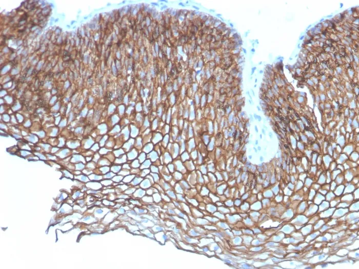 Anti-Desmoglein-3 (Squamous Cell Marker)(DSG3/2837) - image 1