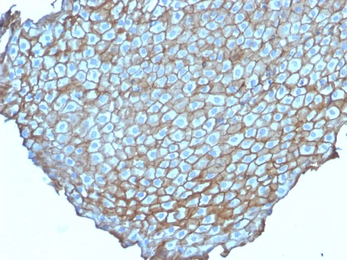 Anti-Desmoglein-3 (Squamous Cell Marker)(DSG3/2838) - image 1