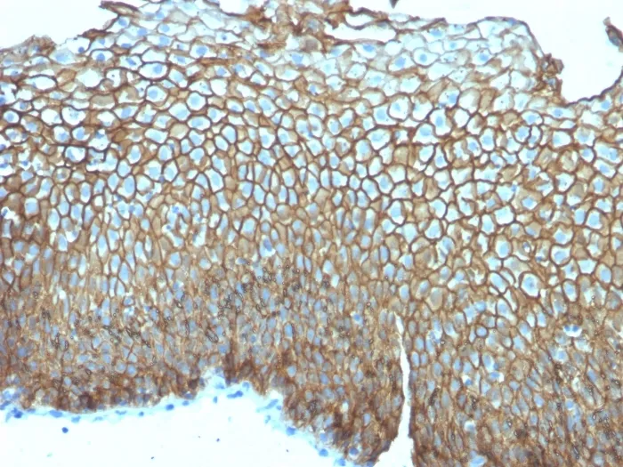 Anti-Desmoglein-3 (Squamous Cell Marker)(DSG3/2839) - image 1