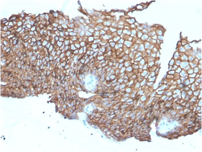 Anti-Desmoglein-3 (Squamous Cell Marker)(DSG3/2840) - image 1