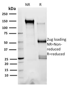 Anti-XRCC3(10F1/6), CF640R conjugate - image 1