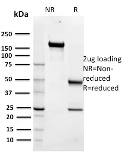 Anti-Maltose Binding Protein / MBP-probe(R29.6), CF568 conjugate - image 1