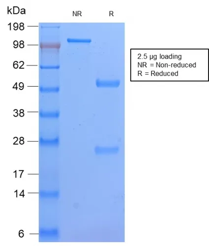 Anti-HLA-DP (MHC II)(HLA-DPB1/2862R) - image 1