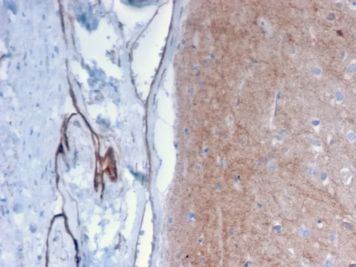 Anti-Drebrin 1 (DBN1)(DBN1/2879), CF647 conjugate - image 1