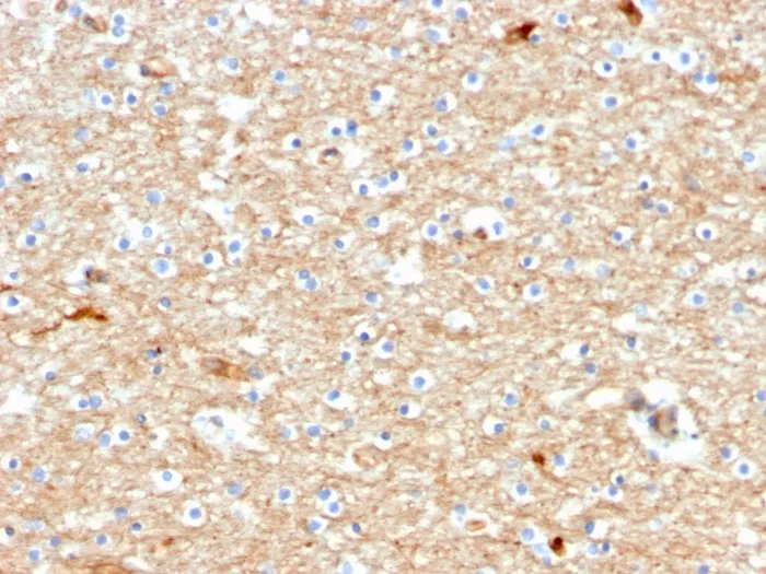 Anti-Drebrin 1 (DBN1)(DBN1/2880), CF568 conjugate - image 1