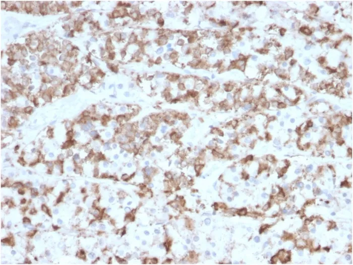 Anti-Prolactin (Pituitary Tumor Marker)(PRL/2910), CF647 conjugate - image 1