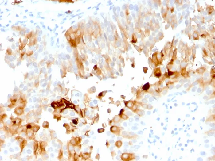 Anti-Uroplakin 1A (Urothelial Differentiation Marker)(UPK1A/2921) - image 1