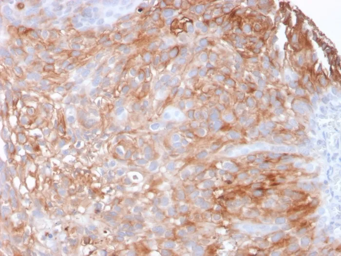 Anti-Uroplakin 1A (Urothelial Differentiation Marker)(UPK1A/2925) - image 1