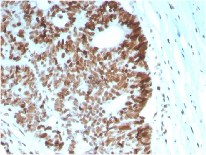 Anti-MSH6 (DNA Mismatch Repair Protein)(MSH6/2927) - image 1