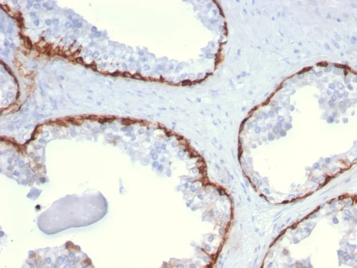 Anti-Cytokeratin 15 (Esophageal Squamous Cell Carcinoma Marker)(KRT15/2959), Biotin conjugate - image 1