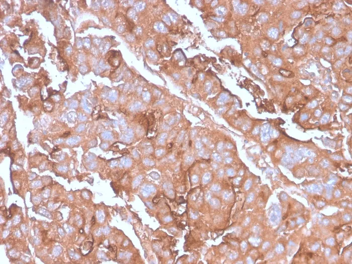 Anti-MUC1 / CA15-3 / EMA / CD227 (Epithelial Marker)(MUC1/2980R) - image 1
