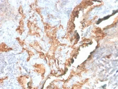 Anti-Tenascin C (Stromal Marker For Epithelial Malignancy) (TNC/2981R) - image 1