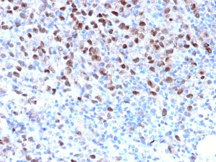 Anti-Microphthalmia Transcription Factor (MITF)(MITF/2987R) - image 1