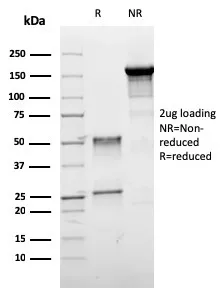 Anti-ER-beta-1 (Estrogen Receptor beta-1)(ESR2/3005) - image 1
