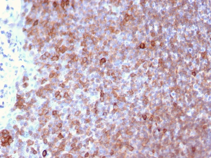 Anti-Lymphocyte Specific Protein 1 (LSP1) / pp52(LSP1/3025) - image 1