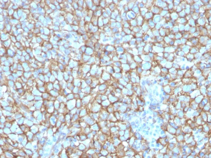 Anti-MCAM (Melanoma Cell Adhesion Molecule) / MUC18 / CD146(MCAM/3048), CF640R conjugate - image 1