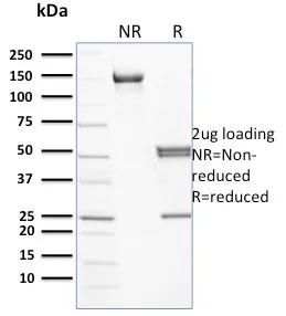 Anti-Spectrin beta I (SPTB)(RG/26) - image 1