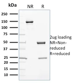 Anti-Cytochrome P450 3A1 / CYP3A1(P6), Biotin conjugate - image 1