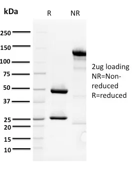 Anti-ORC1(7F6/1), CF594 conjugate - image 1