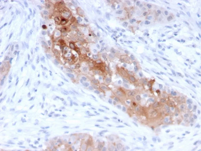 Anti-Desmoglein-1 (DSG1)(32-2B), Biotin conjugate - image 1