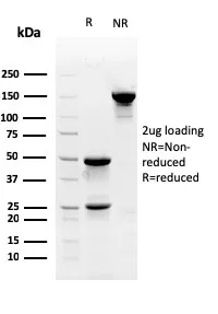 Anti-Myofibroblast Marker(PR 2D3), CF405S conjugate - image 1