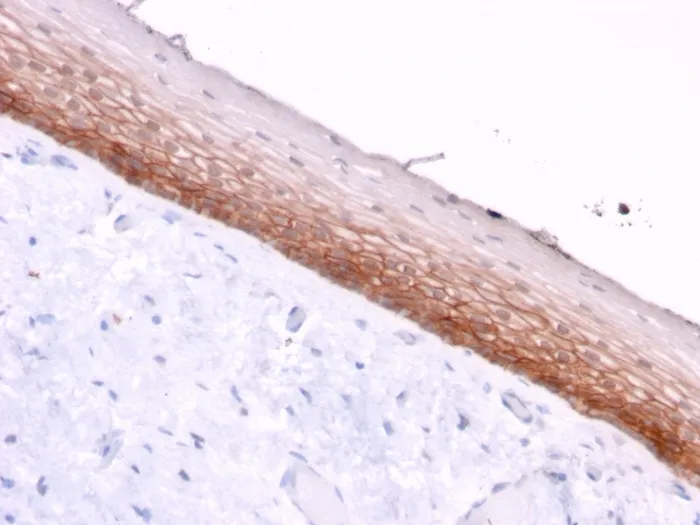 Anti-CD44v4/5 (Marker of Tumor Metastasis)(3D2) - image 1