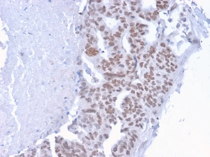 Anti-CHD4(3F2/4), CF640R conjugate - image 1