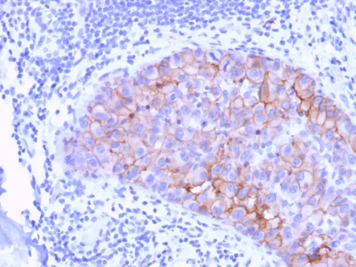 Anti-HER-2 / c-erbB-2 / neu / CD340(ERBB2/3078), Biotin conjugate - image 1