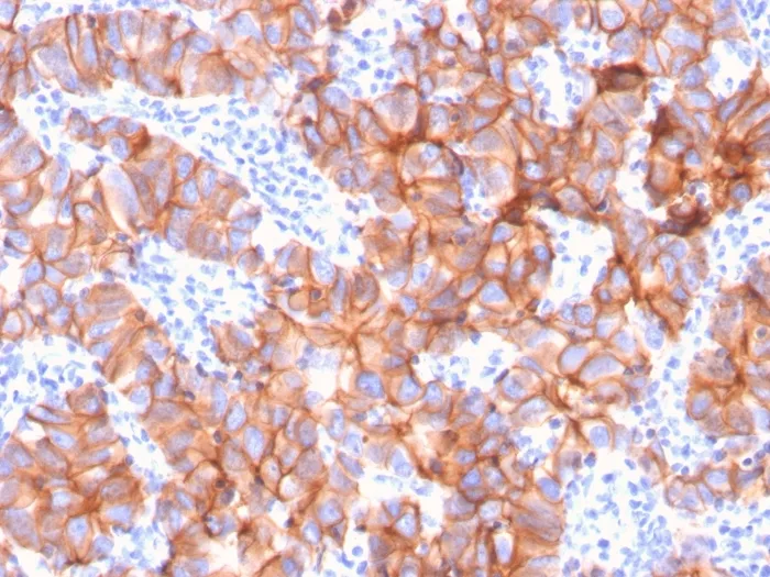 Anti-HER-2 / c-erbB-2 / neu / CD340(ERBB2/3079), CF640R conjugate - image 1