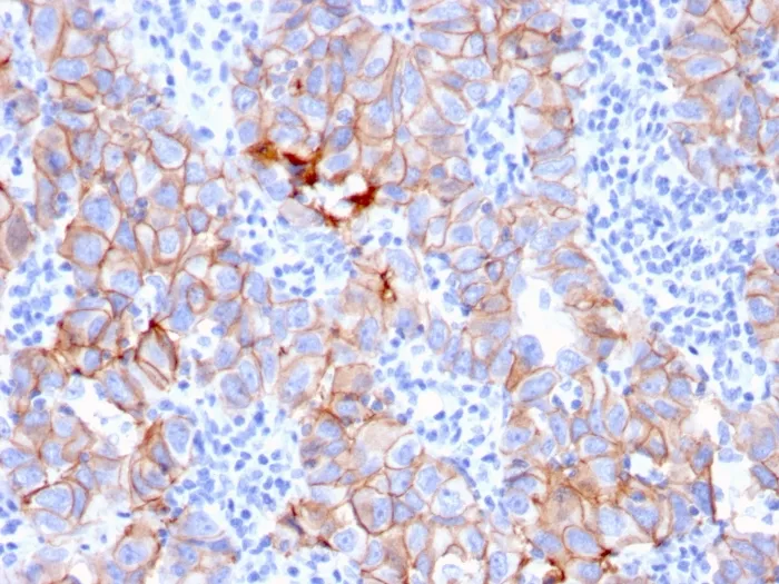 Anti-HER-2 / c-erbB-2 / neu / CD340(ERBB2/3080), Biotin conjugate - image 1