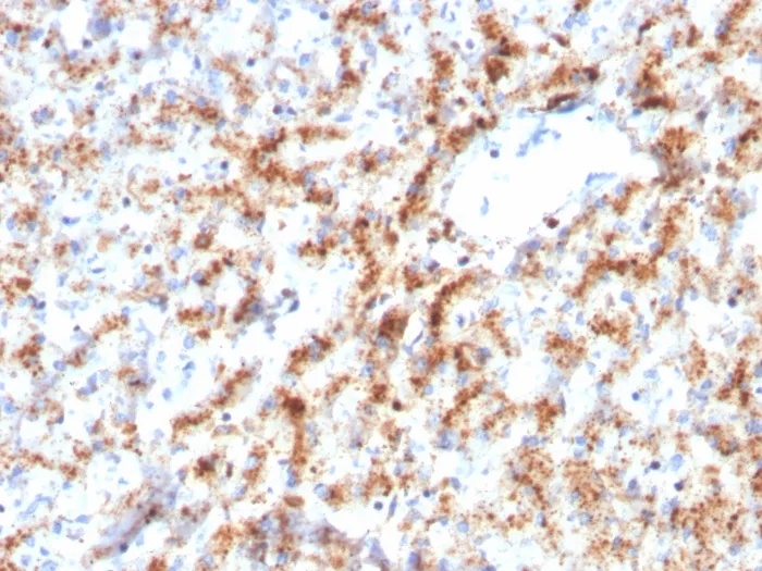 Anti-Cathepsin D (Tumor Marker)(CTSD/3082) - image 1