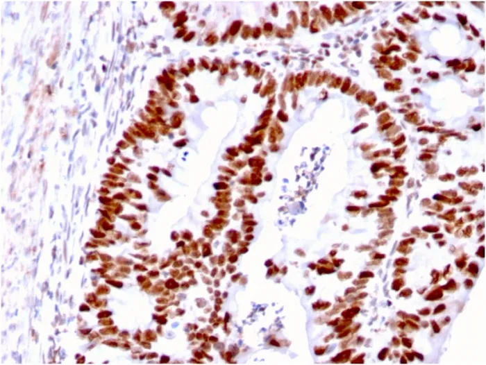 Anti-MSH6 (DNA Mismatch Repair Protein)(MSH6/3085) - image 1