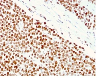 Anti-MSH6 (DNA Mismatch Repair Protein)(MSH6/3086) - image 1