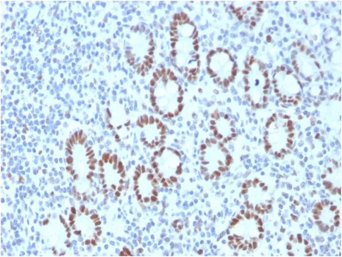 Anti-MSH6 (DNA Mismatch Repair Protein)(MSH6/3089) - image 1