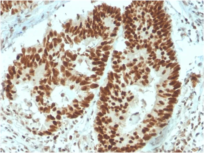 Anti-MSH6 (DNA Mismatch Repair Protein)(MSH6/3091), Biotin conjugate - image 1