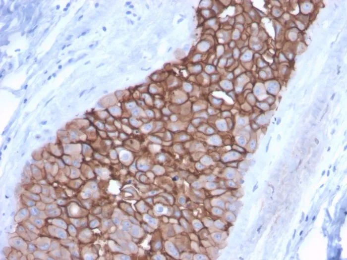 Anti-HER-2 / c-erbB-2 / neu / CD340(ERBB2/3092), CF640R conjugate - image 1