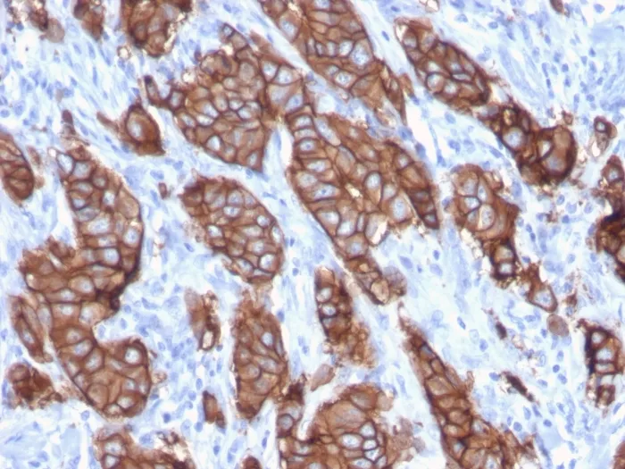 Anti-HER-2 / c-erbB-2 / neu / CD340(ERBB2/3093), Biotin conjugate - image 1