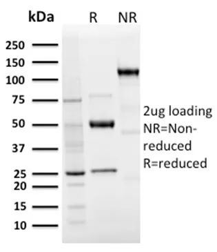 Anti-Langerin / CD207 (Marker of Langerhans Cells)(LGRN/3136R), CF568 conjugate - image 1