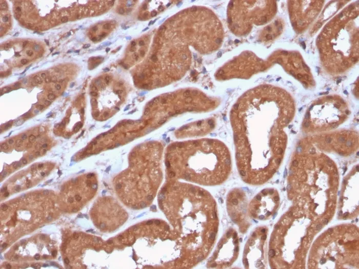 Anti-MTAP (Tumor Suppressor Marker)(MTAP/3137R) - image 1