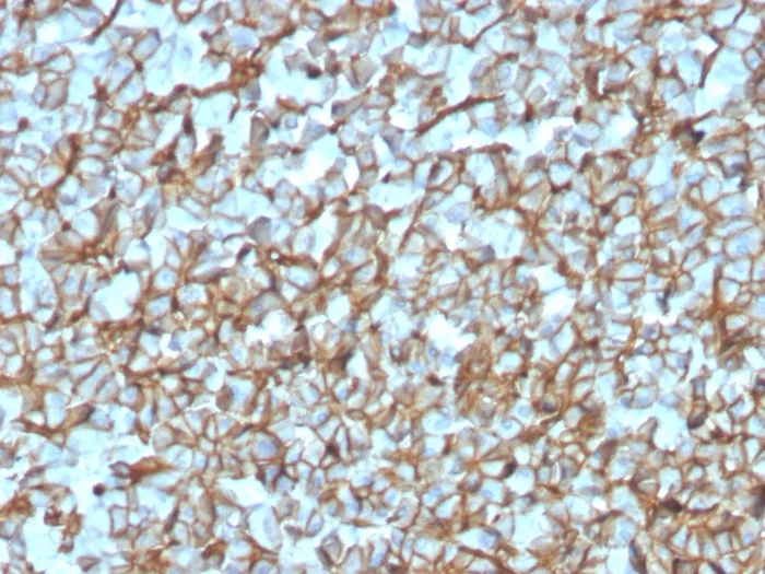 Anti-Spectrin beta III (SPTBN2)(SPTBN2/3142R) - image 1