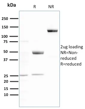 Anti-Ubiquitin (Autophagy Marker)(UBB/3143R) - image 1