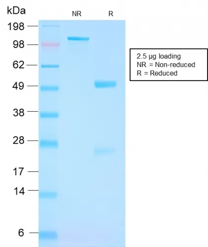 Anti-FOLH1 / PSMA (Prostate Epithelial Marker)(FOLH1/3149R) - image 1