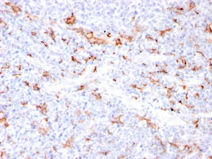 Anti-S100A9 + Calprotectin (S100A8/A9 Complex)(MAC3157R) - image 1