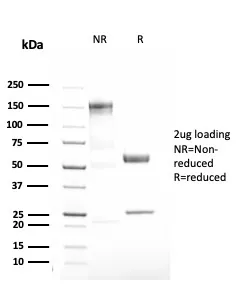 Anti-Alpha-1-Antitrypsin (SERPINA1) (Hepatocellular & Histiocytic Marker)(AAT/3167R), CF405S conjugate - image 1