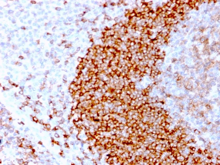 Anti-CD79b (B-Cell Marker)(IGB/3170R) - image 1